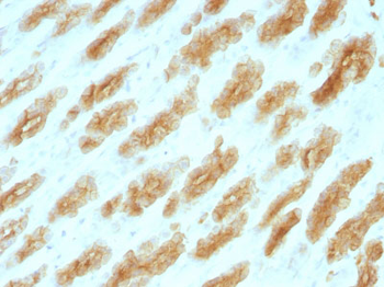 Cytokeratin, Basic (Type II or HMW) (Epithelial Marker) Antibody - With BSA and Azide