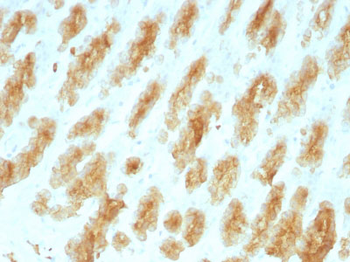 Cytokeratin, Acidic (Type I or LMW) (Epithelial Marker) Antibody - With BSA and Azide