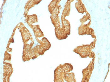 Cytokeratin, Acidic (Type I or LMW) (Epithelial Marker) Antibody - With BSA and Azide