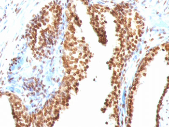 Double Stranded DNA (dsDNA) (Nuclear Marker) Antibody - With BSA and Azide
