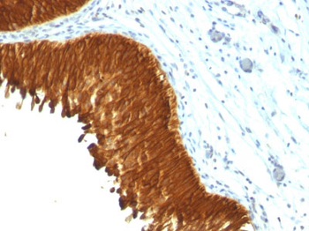 Cytokeratin, Multi (Epithelial Marker) Antibody - With BSA and Azide