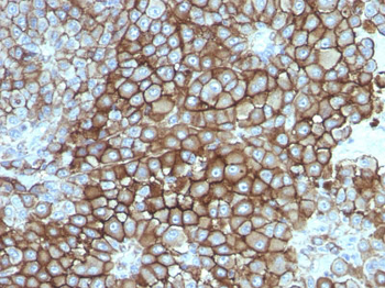 KBA.62 (Melanoma Associated Antigen) Antibody - With BSA and Azide