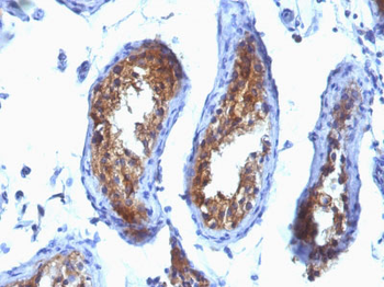 Major Vault Protein (MVP) Antibody - With BSA and Azide