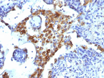 Napsin A (Lung Adenocarcinoma Marker) Antibody - With BSA and Azide