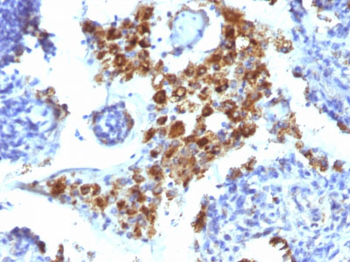 Napsin A (Lung Adenocarcinoma Marker) Antibody - With BSA and Azide