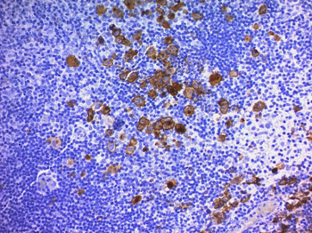 CD30 / TNFRSF8 (Hodgkin & Reed-Sternberg Cell Marker) Antibody - Culture Supernatant