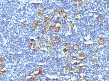 CD30 / TNFRSF8 (Hodgkin & Reed-Sternberg Cell Marker) Antibody - Culture Supernatant