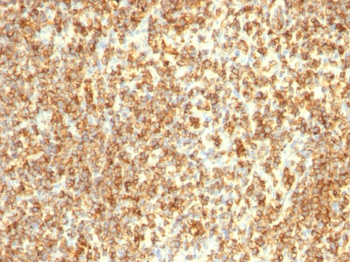 CD20 / MS4A1 (B-Cell Marker) Antibody - Culture Supernatant