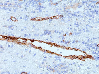 von Willebrand Factor / Factor VIII Related-Ag (Endothelial Marker) Antibody - With BSA and Azide