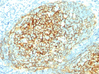 CD106 / VCAM1 (Activated Endothelial Cell Marker) Antibody - With BSA and Azide