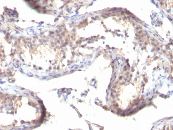 TGF-alpha (Transforming Growth Factor alpha) Antibody - With BSA and Azide