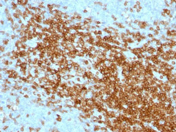 CD43 (T-Cell Marker) Antibody - With BSA and Azide
