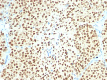 SOX10 (Melanoma Marker) Antibody - With BSA and Azide