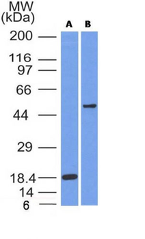 SOX10 (Melanoma Marker) Antibody - With BSA and Azide