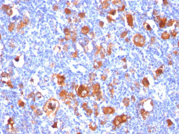 Fascin-1 (Reed-Sternberg Cell Marker) Antibody - With BSA and Azide