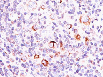 Bcl-X (Apoptosis Marker) Antibody - With BSA and Azide