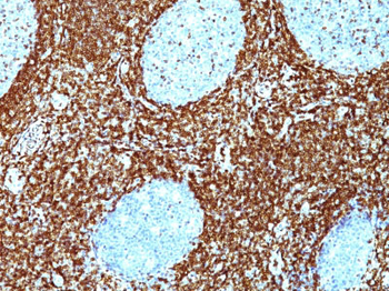 Bcl-2 (Apoptosis & Follicular Lymphoma Marker) Antibody - With BSA and Azide