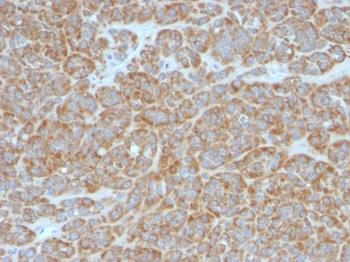 Bcl-2 (Apoptosis & Follicular Lymphoma Marker) Antibody - With BSA and Azide
