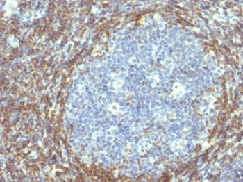 Bcl-2 (Apoptosis & Follicular Lymphoma Marker) Antibody - With BSA and Azide