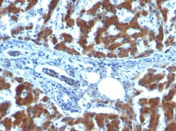 Retinol Binding Protein-1 (RBP1) Antibody - With BSA and Azide