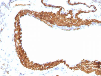 Actin, Smooth Muscle (Leiomyosarcoma Marker) Antibody - With BSA and Azide