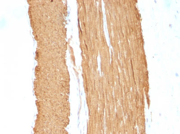 Actin, Smooth Muscle (Leiomyosarcoma Marker) Antibody - With BSA and Azide
