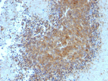 Bax (Apoptosis Marker) Antibody - With BSA and Azide