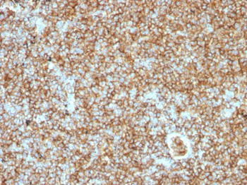 CD45RB (B-Cell Marker) Antibody - With BSA and Azide