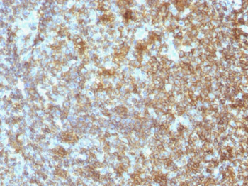 CD45 / LCA (Leucocyte Marker) Antibody - With BSA and Azide