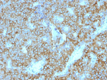 Parathyroid Hormone (PTH) (C-Terminal) Antibody - With BSA and Azide