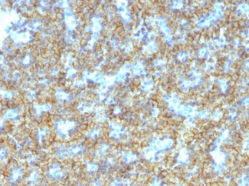 Parathyroid Hormone (PTH) (C-Terminal) Antibody - With BSA and Azide