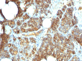Parathyroid Hormone (PTH) (C-Terminal) Antibody - With BSA and Azide