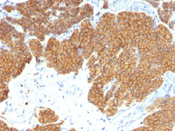 Parathyroid Hormone (PTH) (N-Terminal) Antibody - With BSA and Azide