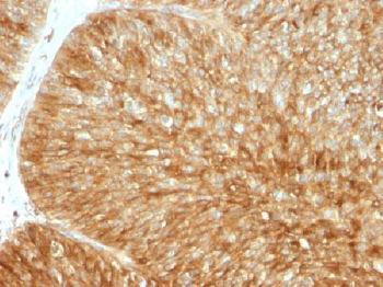 Beta-2 Microglobulin (Renal Failure & Tumor Marker) Antibody - With BSA and Azide