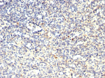 TRAcP (Tartrate-Resistant Acid Phosphatase) (Hairy Cell Leukemia Marker) Antibody - With BSA and Az