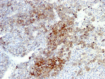 NGF-Receptor (p75) / CD271 (Soft Tissue Tumor Marker) Antibody - With BSA and Azide