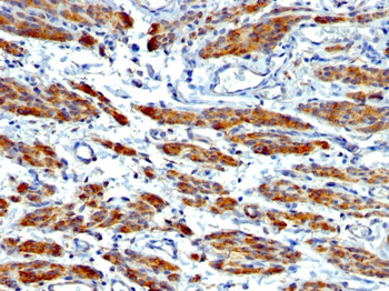 Smooth Muscle Myosin Heavy Chain (SM-MHC) (Leiomyosarcoma & Myoepithelial Cell Marker) Antibody - W
