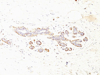 Smooth Muscle Myosin Heavy Chain (SM-MHC) (Leiomyosarcoma & Myoepithelial Cell Marker) Antibody - W