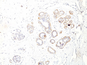 Smooth Muscle Myosin Heavy Chain (SM-MHC) (Leiomyosarcoma & Myoepithelial Cell Marker) Antibody - W