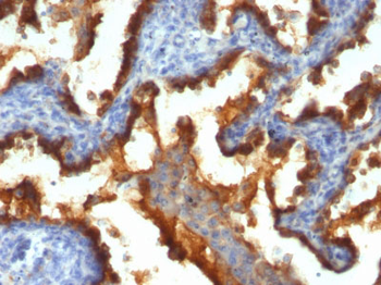 MUC1 / EMA / CD227 (Epithelial Marker) Antibody - With BSA and Azide