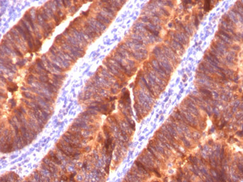 MUC1 / EMA / CD227 (Epithelial Marker) Antibody - With BSA and Azide