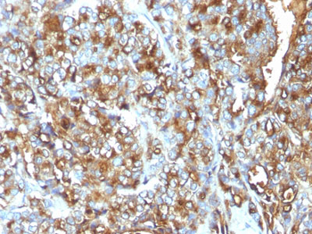 MUC1 / EMA / CD227 (Epithelial Marker) Antibody - With BSA and Azide