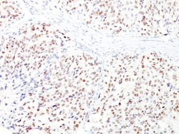 Microphthalmia Transcription Factor (MITF) Antibody - With BSA and Azide