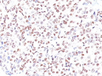 Microphthalmia Transcription Factor (MITF) Antibody - With BSA and Azide