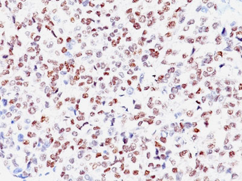 Microphthalmia Transcription Factor (MITF) Antibody - With BSA and Azide