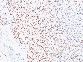 Microphthalmia Transcription Factor (MITF) Antibody - With BSA and Azide