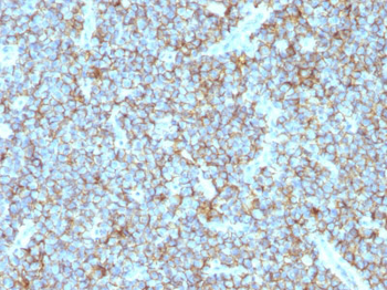 CD99 / MIC2 (Ewing's Sarcoma Marker) Antibody - With BSA and Azide