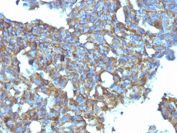 CD99 / MIC2 (Ewing's Sarcoma Marker) Antibody - With BSA and Azide