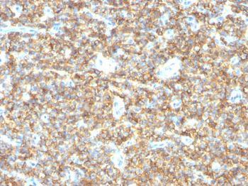 CD99 / MIC2 (Ewing's Sarcoma Marker) Antibody - With BSA and Azide