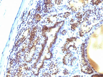 MAP3K1 (Mitogen-Activated Protein Kinase Kinase Kinase 1) Antibody - With BSA and Azide